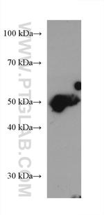 PPARD Antibody in Western Blot (WB)