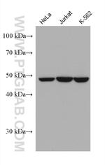 PPARD Antibody in Western Blot (WB)