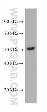 PPARD Antibody in Western Blot (WB)