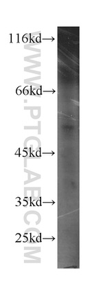 PPARD Antibody in Western Blot (WB)