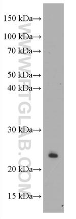 CD3 delta Antibody in Western Blot (WB)