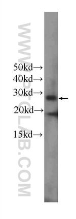 CD3 delta Antibody in Western Blot (WB)