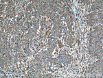 FAS/CD95 Antibody in Immunohistochemistry (Paraffin) (IHC (P))