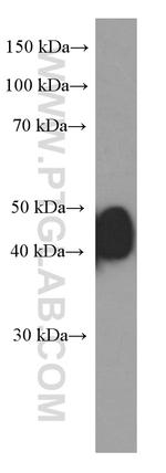 ESR2 Antibody in Western Blot (WB)