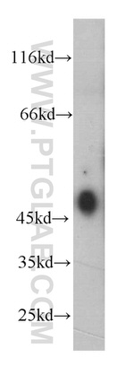 ESR2 Antibody in Western Blot (WB)