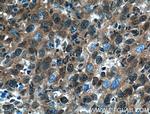 STAT3 Antibody in Immunohistochemistry (Paraffin) (IHC (P))