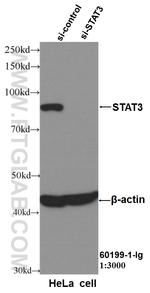 STAT3 Antibody in Western Blot (WB)