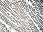 STAT3 Antibody in Immunohistochemistry (Paraffin) (IHC (P))