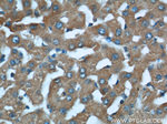 STAT3 Antibody in Immunohistochemistry (Paraffin) (IHC (P))