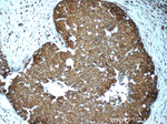 STAT3 Antibody in Immunohistochemistry (Paraffin) (IHC (P))