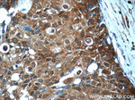 STAT3 Antibody in Immunohistochemistry (Paraffin) (IHC (P))