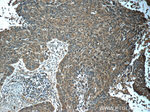 STAT3 Antibody in Immunohistochemistry (Paraffin) (IHC (P))