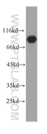 STAT3 Antibody in Western Blot (WB)