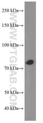 STAT3 Antibody in Western Blot (WB)