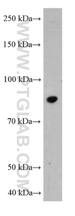 STAT3 Antibody in Western Blot (WB)