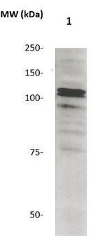 Phospho-Catenin-Delta1 (Tyr96) Antibody in Western Blot (WB)