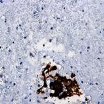 VEGFR-2 (CD309) Antibody in Immunohistochemistry (Paraffin) (IHC (P))