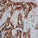 GSK-3b Antibody in Immunohistochemistry (Paraffin) (IHC (P))