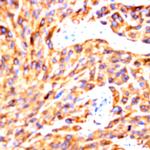 FLT1 Peptide Antibody in Immunohistochemistry (Paraffin) (IHC (P))