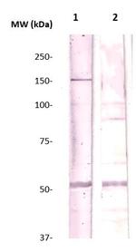 Rho Kinase/ROCKII Antibody in Western Blot (WB)