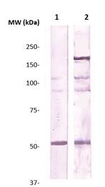 Rho Kinase/ROCKII Antibody in Western Blot (WB)