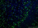 ZAP70 Antibody in Immunohistochemistry (PFA fixed) (IHC (PFA))