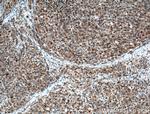 ZAP70 Antibody in Immunohistochemistry (Paraffin) (IHC (P))