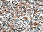 ZAP70 Antibody in Immunohistochemistry (Paraffin) (IHC (P))