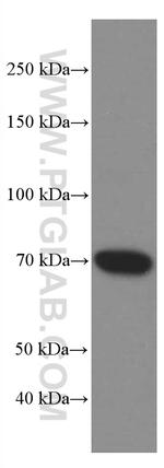 ZAP70 Antibody in Western Blot (WB)