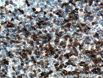 ZAP70 Antibody in Immunohistochemistry (Paraffin) (IHC (P))