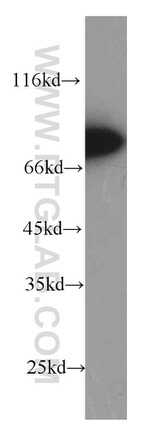 ZAP70 Antibody in Western Blot (WB)