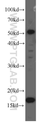 UBC9 Antibody in Western Blot (WB)