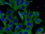 peroxiredoxin 2 Antibody in Immunocytochemistry (ICC/IF)