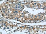 peroxiredoxin 2 Antibody in Immunohistochemistry (Paraffin) (IHC (P))