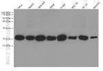 peroxiredoxin 2 Antibody in Western Blot (WB)