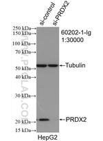 peroxiredoxin 2 Antibody in Western Blot (WB)