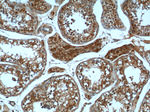 peroxiredoxin 2 Antibody in Immunohistochemistry (Paraffin) (IHC (P))