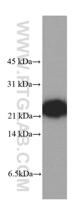 peroxiredoxin 2 Antibody in Western Blot (WB)