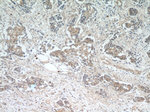 AKT Antibody in Immunohistochemistry (Paraffin) (IHC (P))