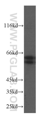 AKT Antibody in Western Blot (WB)