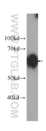 AKT Antibody in Western Blot (WB)