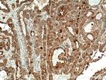 Galectin-3 Antibody in Immunohistochemistry (Paraffin) (IHC (P))