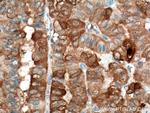 Galectin-3 Antibody in Immunohistochemistry (Paraffin) (IHC (P))