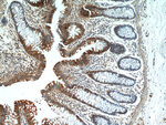 Galectin-3 Antibody in Immunohistochemistry (Paraffin) (IHC (P))