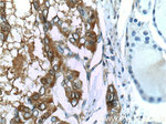 Galectin-3 Antibody in Immunohistochemistry (Paraffin) (IHC (P))