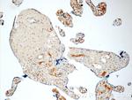 LYN Antibody in Immunohistochemistry (Paraffin) (IHC (P))