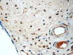 LYN Antibody in Immunohistochemistry (Paraffin) (IHC (P))