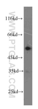 LYN Antibody in Western Blot (WB)