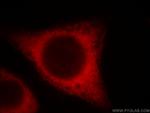 BCS1L Antibody in Immunocytochemistry (ICC/IF)