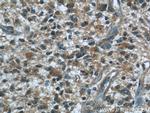 BCS1L Antibody in Immunohistochemistry (Paraffin) (IHC (P))